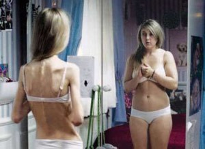 Anoressia