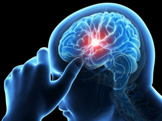 Ictus cerebrale terapia, trombectomia meccanica su 78enne a Terni