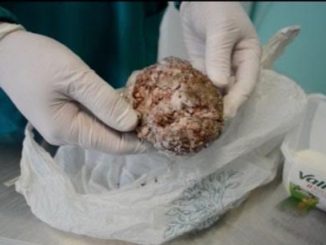 Animali avvelenati, anche a Deruta l'allarme "Polpette"