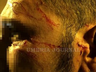 Famiglia aggredita da alcuni profughi africani a Terni - Guarda la foto