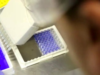 Casi morbillo in Umbria, Assessore Barberini, vaccino unica arma utile