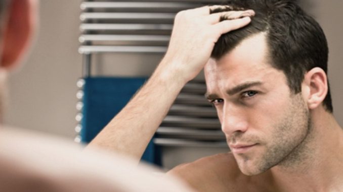 Istituto Helvetico Sanders Perugia quando preoccupa la caduta dei capelli