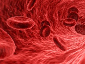 Sepsi infezione pericolosa, diagnosi precoce a Perugia si può