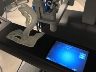 Spoleto, primo intervento chirurgico robotico con tecnologia stampa 3D
