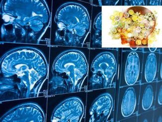 Ospedale Foligno, prestigiosa indagine nazionale sulla neuroriabilitazione