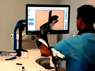 Recupero mano e braccio dopo ictus cerebrale usando il robot