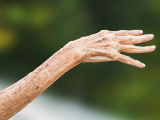 Asl Umbria 2 chiede 11mila 612 euro a un anziano malato cronico