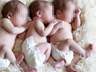 Parto trigemellare raro all’ospedale di Perugia, nate nella stessa placenta 