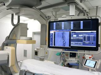Installato nuovo angiografo trattamenti efficaci sui pazienti colpiti da infarto