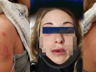 Pesta a sangue la compagna lei mette le foto su FB e lo denuncia