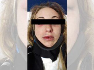 Ragazza di Bastia massacrata di botte, i medici le avrebbero dato 10 giorni di prognosi