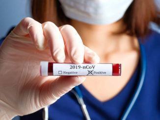 Salgono a tre i casi positivi di Coronavirus ad Assisi, a Santa Maria attivo il centro operativo