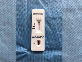 Coronavirus, sospeso l'avvio dei test rapidi dopo ispezioni di Nas e Asl