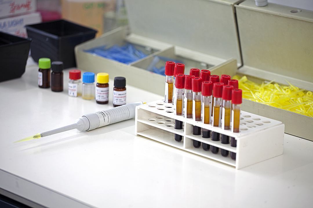 Covid, test rapidi, medici di famiglia e i pediatri iniziano da oggi