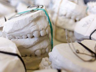 Caso Dentix, tanti clienti beffati, ma un possibile spiraglio di riapertura c'è