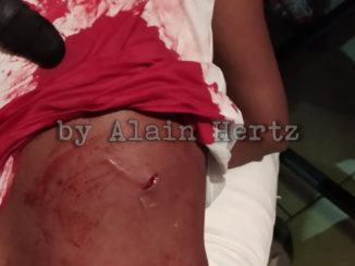 Rissa sanguinaria nella notte alle porte di Perugia, bottigliate e coltellate in discoteca