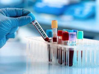 Tumori: italiani scoprono nuovo meccanismo per 'affamare' cancro 