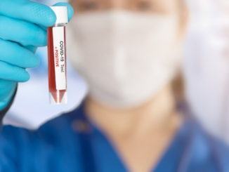 Estensione effettuazione test molecolare covid ai punti prelievi In Umbria