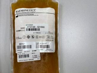 Plasma iperimmune, Umbria seconda per pazienti riceventi arruolati