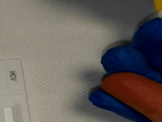 A Perugia, SoS: progetto di prevenzione all’Epatite C dedicato alle popolazioni speciali, è una priorità della sanità pubblica