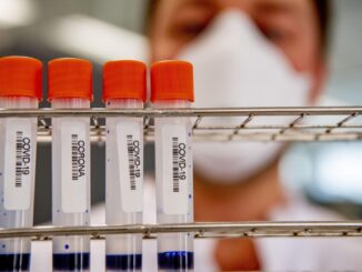 Covid lieve calo dei positivi in Umbria risalgono i ricoverati