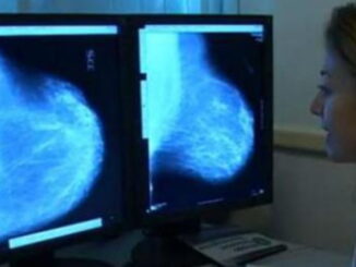 Tumori, in Umbria l’80,8% degli interventi entro i 30 giorni