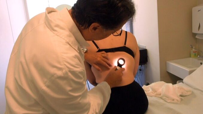 Tumori Italia +7% casi melanoma l'anno, ridotto rischio under 45