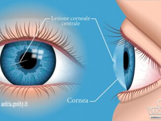 Cornea artificiale da pelle maiale speranza per chi aspetta trapianto
