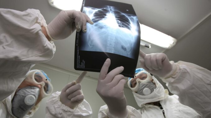 Salute: reumatologo Tirri, 'molti pazienti non sanno di avere l'artrite psoriasica'