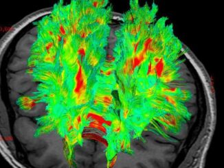 Grasso e cervello si parlano, scienziati 'origliati neuroni sensoriali' 