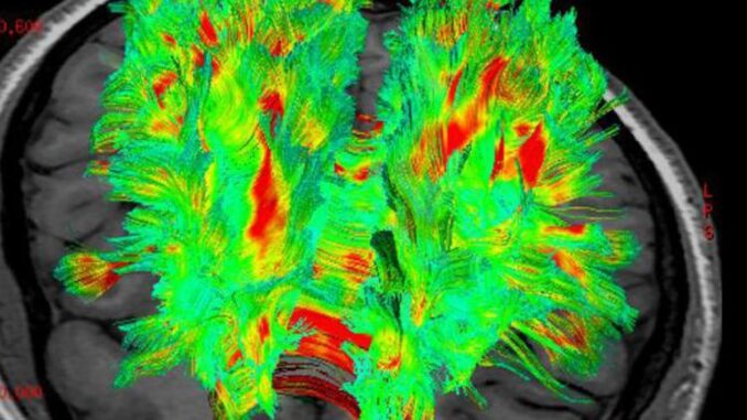 Grasso e cervello si parlano, scienziati 'origliati neuroni sensoriali' 