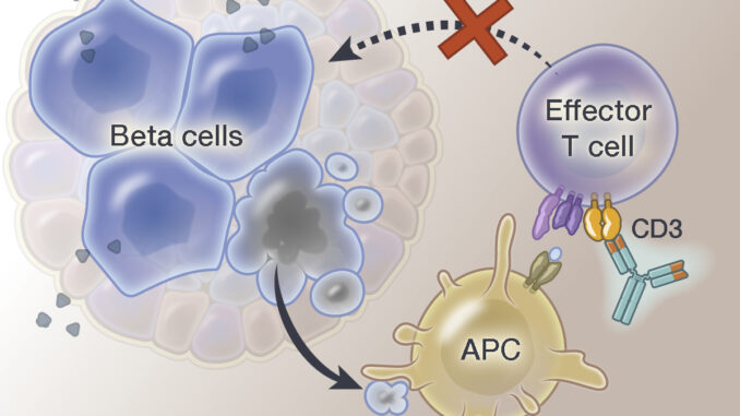 Approvata la prima terapia cellulare per il diabete di tipo 1