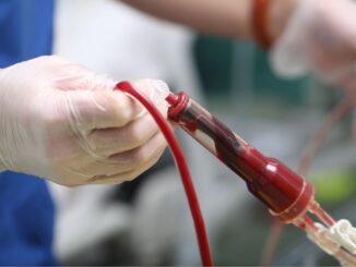 Chirurgo opera senza trasfusioni, blocco difese immunitarie