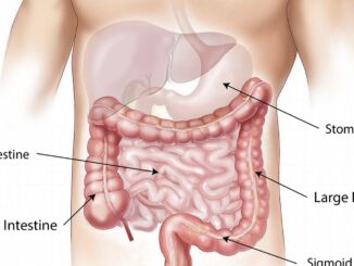 Trovata strategia per curare cancro colon con immunoterapia