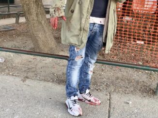 Rissa sanguinaria a Fontivegge, bottigliate in faccia a sudamericano