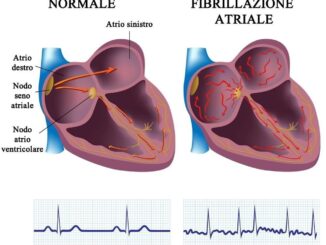 Radiazioni anticancro curano il 'cuore matto', studio Irccs Negrar 