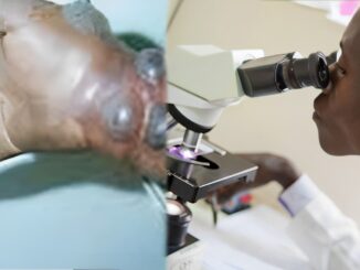 Oms, al lavoro con Tanzania per risposta a epidemia virus Marburg