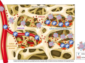 Nuove cellule Car Cik, riconoscono e aggrediscono cellule leucemia mieloide acuta, nello studio anche UniPg