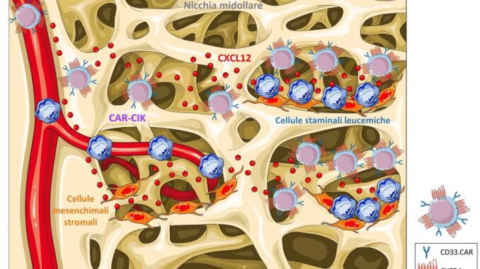 Nuove cellule Car Cik, riconoscono e aggrediscono cellule leucemia mieloide acuta, nello studio anche UniPg