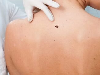 Melanoma: buoni risultati da mix vaccino e immunoterapia