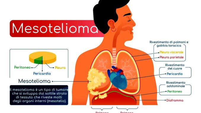 Sistema molecolare velocizza diagnosi cancro da amianto