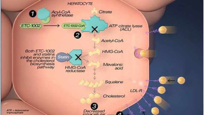 Nuova cura contro il colesterolo riduce il rischio di infarto
