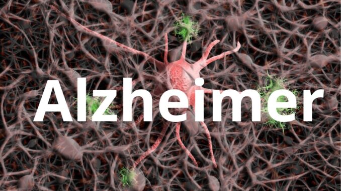 Nuovo farmaco rallenta l'Alzheimer è un anticorpo monoclonale