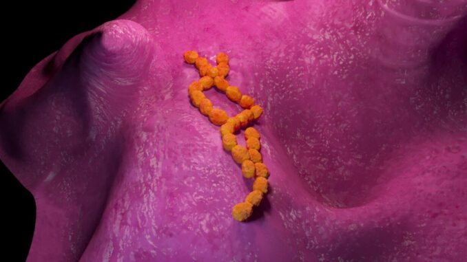 Scende frequenza forme gravi streptococco A, dopo Covid