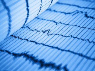 Polemiche sulla Mancanza di Primari nelle Cardiologie Umbre