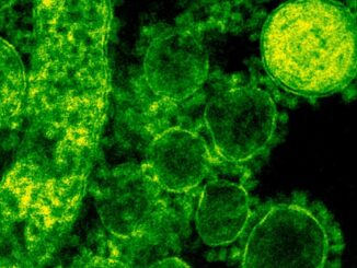Australia: Primo Caso Umano di Influenza Aviaria H5N1 nel Paese