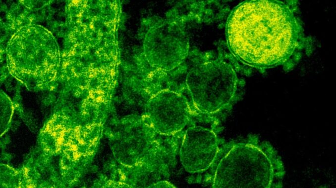Australia: Primo Caso Umano di Influenza Aviaria H5N1 nel Paese