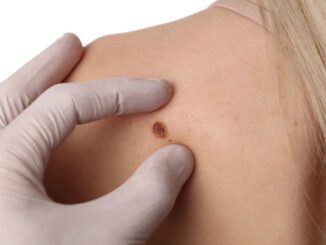Il promettente vaccino personalizzato a mRna contro il melanoma