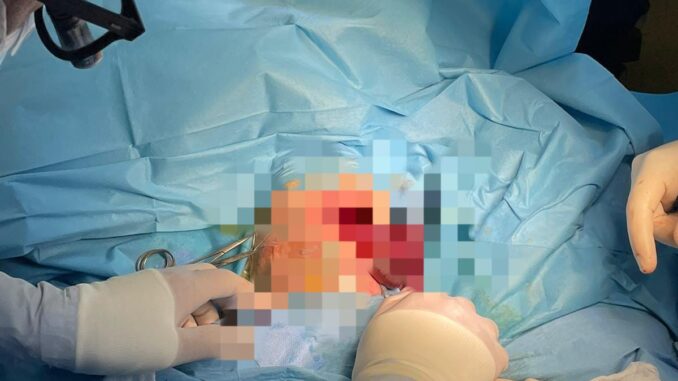 Neonata di 5 mesi operata con successo di ernia diaframmatica
