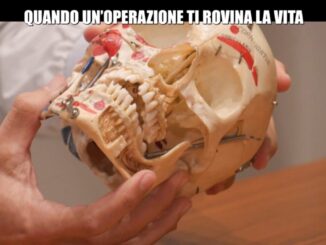 Chirurgia mandibolare sotto accusa dopo il caso Mediaset